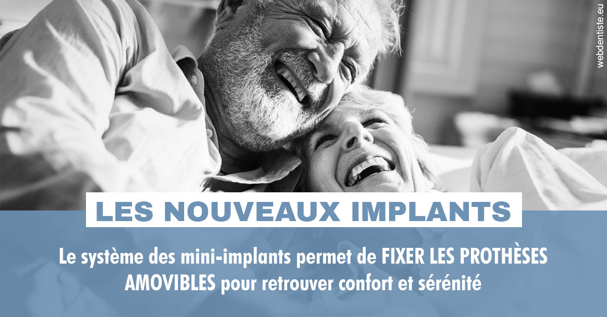 https://dr-ohana-gabriel.chirurgiens-dentistes.fr/Les nouveaux implants 2