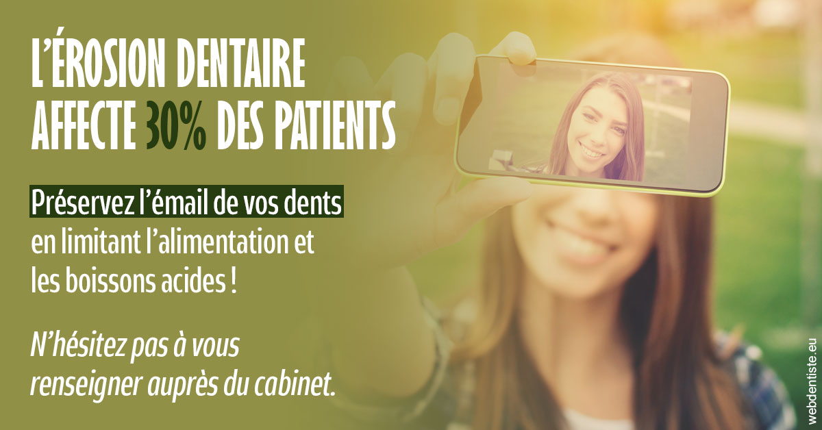 https://dr-ohana-gabriel.chirurgiens-dentistes.fr/L'érosion dentaire 1