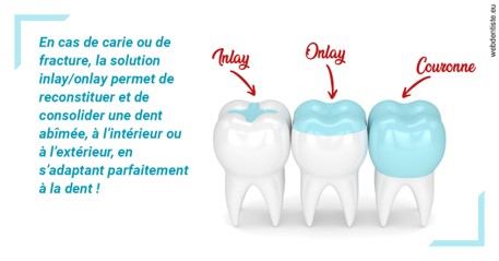 https://dr-ohana-gabriel.chirurgiens-dentistes.fr/L'INLAY ou l'ONLAY