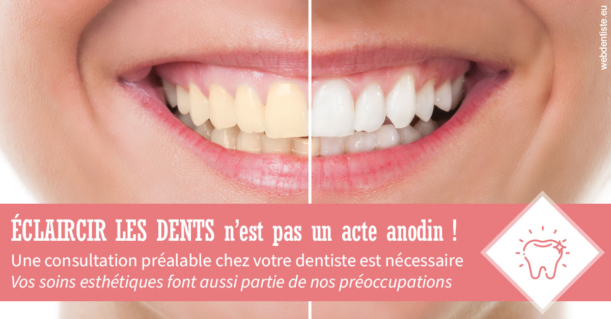 https://dr-ohana-gabriel.chirurgiens-dentistes.fr/Eclaircir les dents 1