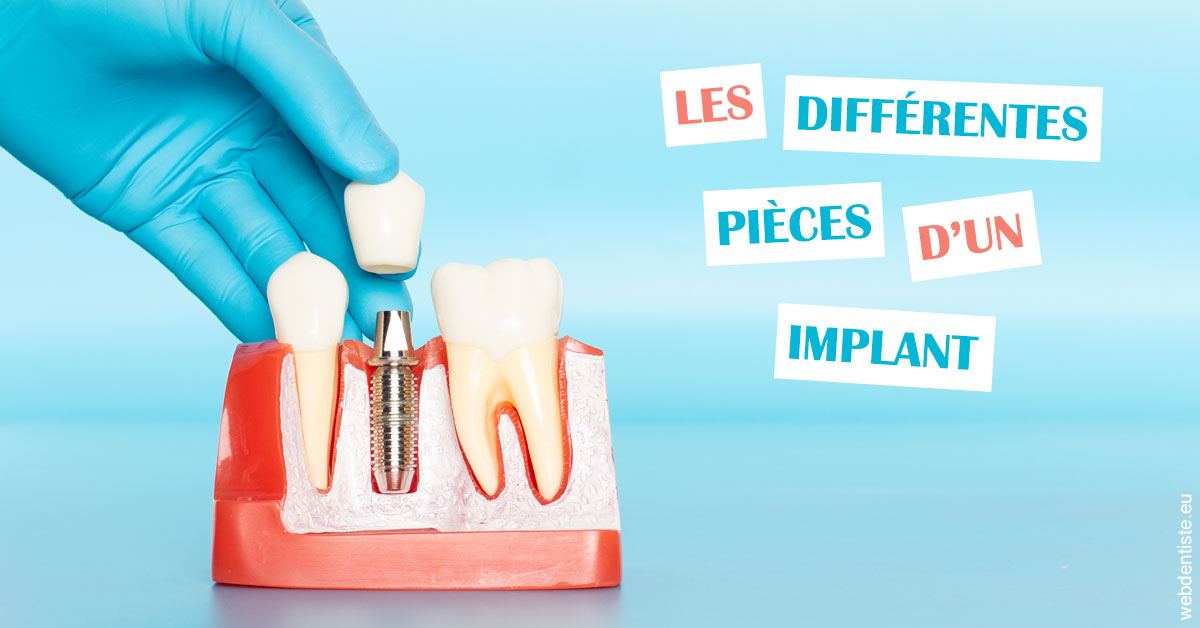 https://dr-ohana-gabriel.chirurgiens-dentistes.fr/Les différentes pièces d’un implant 2