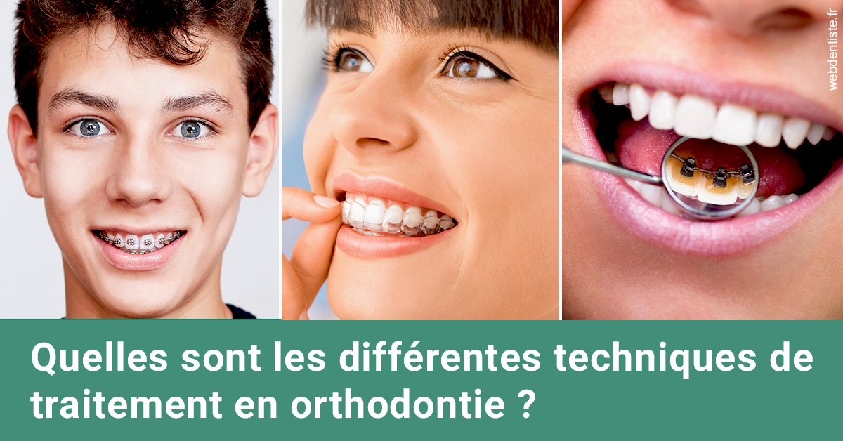 https://dr-ohana-gabriel.chirurgiens-dentistes.fr/Les différentes techniques de traitement 2