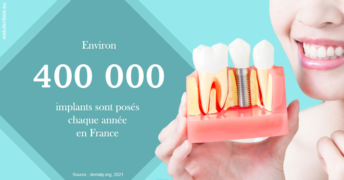 https://dr-ohana-gabriel.chirurgiens-dentistes.fr/Pose d'implants en France 2